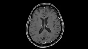 Advancing MSA Research