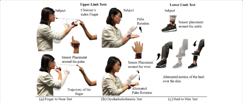 Tests-for-evaluation-of-cerebellar-ataxia-disorder-Finger-to-Nose-test-for-upper-limb
